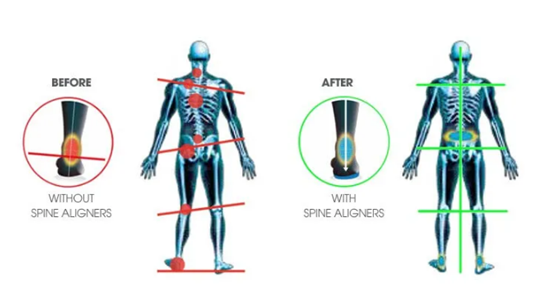 耐樂(lè)途功能鞋 呵護(hù)雙足 關(guān)注青少年脊柱健康